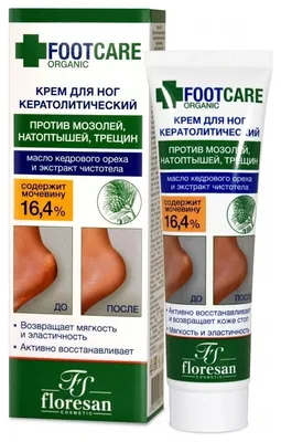 INNORTO Гелевые подушечки для обуви и ног от мозолей, натоптышей при  поперечном плоскостопии - купить с доставкой по выгодным ценам в  интернет-магазине OZON (1214472657)