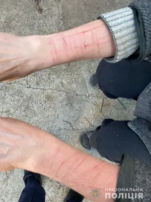 Боль, длинные порезы на руках …» — создано в Шедевруме