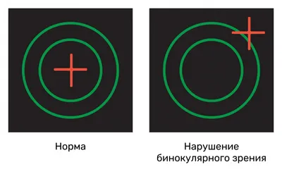 Таблица для проверки зрения у окулиста: Сивцева и другие