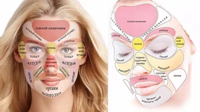Прыщи на лице картинки фотографии
