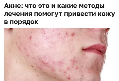 Духовные причины прыщей и аллергических пятен. | сергей примм | Дзен