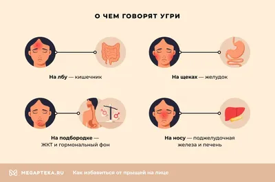 Прыщи на лице после 30 лет - причины и лечение в Санкт-Петербурге