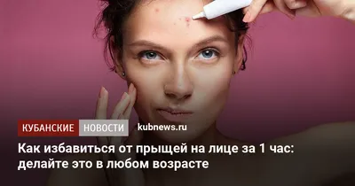 Дерматолог рассказала, о каких заболеваниях могут говорить прыщи на лице |  Радио 1