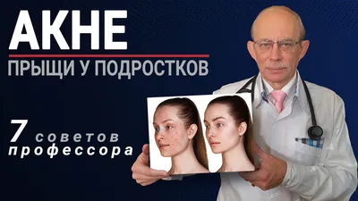 Эти крошечные прыщи на моем лице — аллергическая реакция? - Все про аллергию