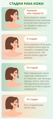 Врачи назвали признаки рака кожи, которые видны на лице