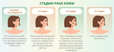 Диагностика и лечение меланомы и базалиомы