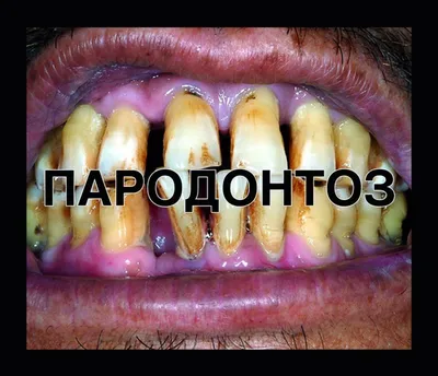 История страшных картинок на пачках сигарет: кто их придумал и зачем они  нужны | Nicton | Комплексное снабжение никотиновых производств | Дзен