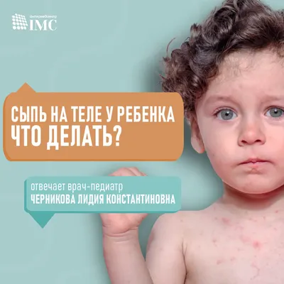 Сыпь на теле ребенка, что это? - Вопросы о детях - BabyPlan