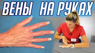 Вопрос дня! Вены на руках это красиво? До съемки я даже не знал, что у... |  TikTok