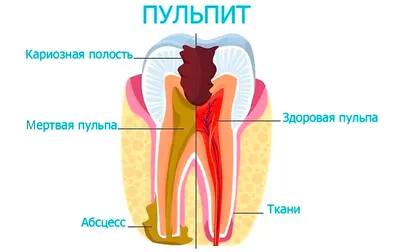 лечение лимфоузлов на шее｜Поиск в TikTok