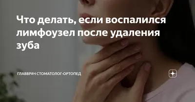 У ребенка увеличились лимфоузлы. В чем причина и что делать? | Журнал  Доктора Комаровського