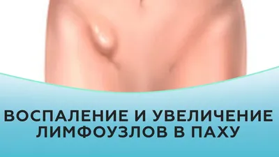 увеличение лимфоузлов на шее｜Búsqueda de TikTok