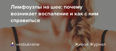 лимфоузлы на шее лечение｜Búsqueda de TikTok