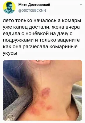 Давай немного выборов на пошлость?❤ 1) Шея/Ключица 2) Засосы на шее/Засосы  на груди 3) Грудь/Орех 4) Нежность/Страсть 5) Целовать, прижимая к  стене/Целовать прижимая к себе 6) Кусать верхнюю губу/Кусать нижнюю губу. |
